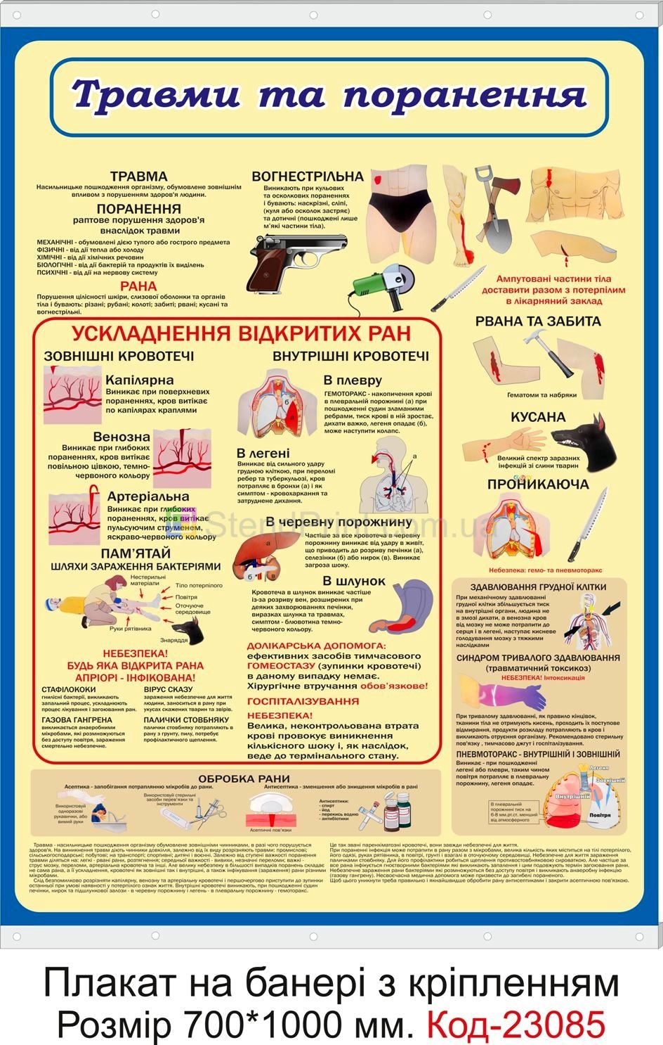 Плакат на банері з направляючими "Травми та поранення"